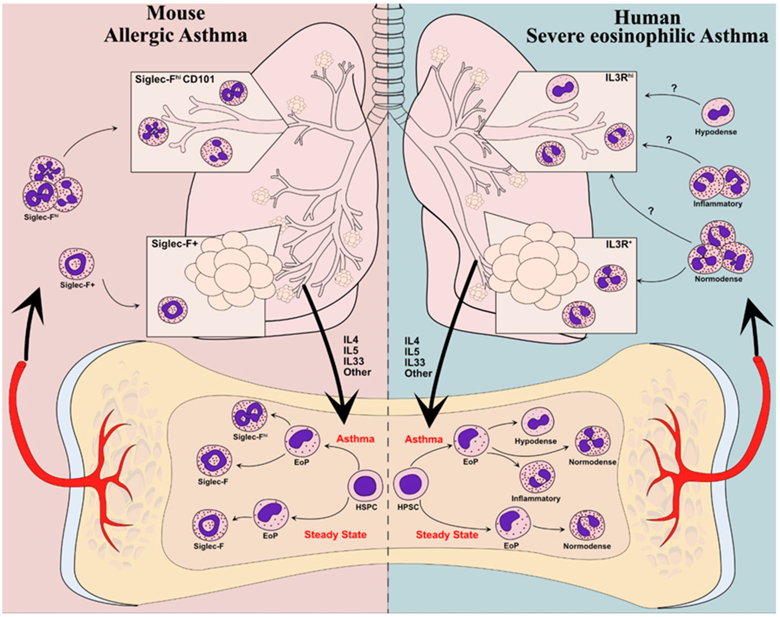 What is the Difference between Asthma And Eosinophilic Asthma?